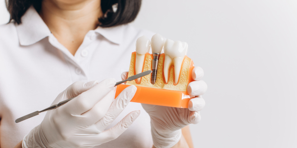 IMPLANT
